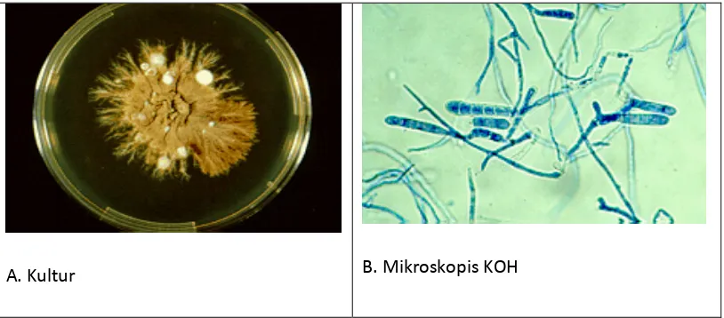 Gambar 2.12: A. Gambaran Kultur Microsporum gallinae dan 
