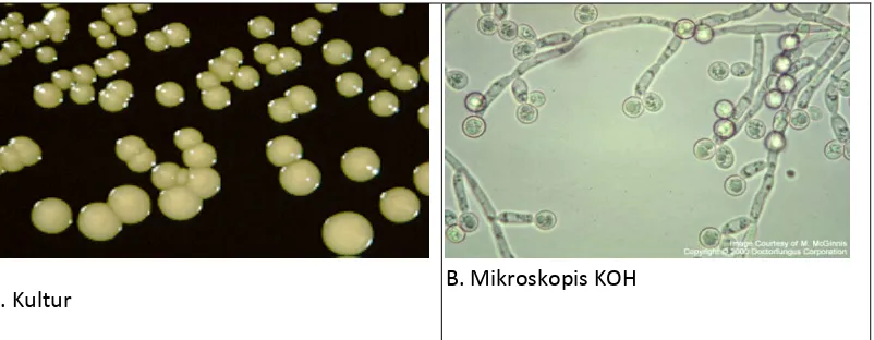 Gambar 2.14: A. Gambaran Kultur Candida albicans dan  B. Gambaran Mikroskopis KOH Candida albicans