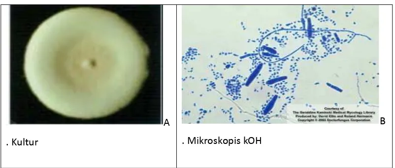 Gambar 2.2: A. Gambaran Kultur Trichophyton Mentagrophytes dan 