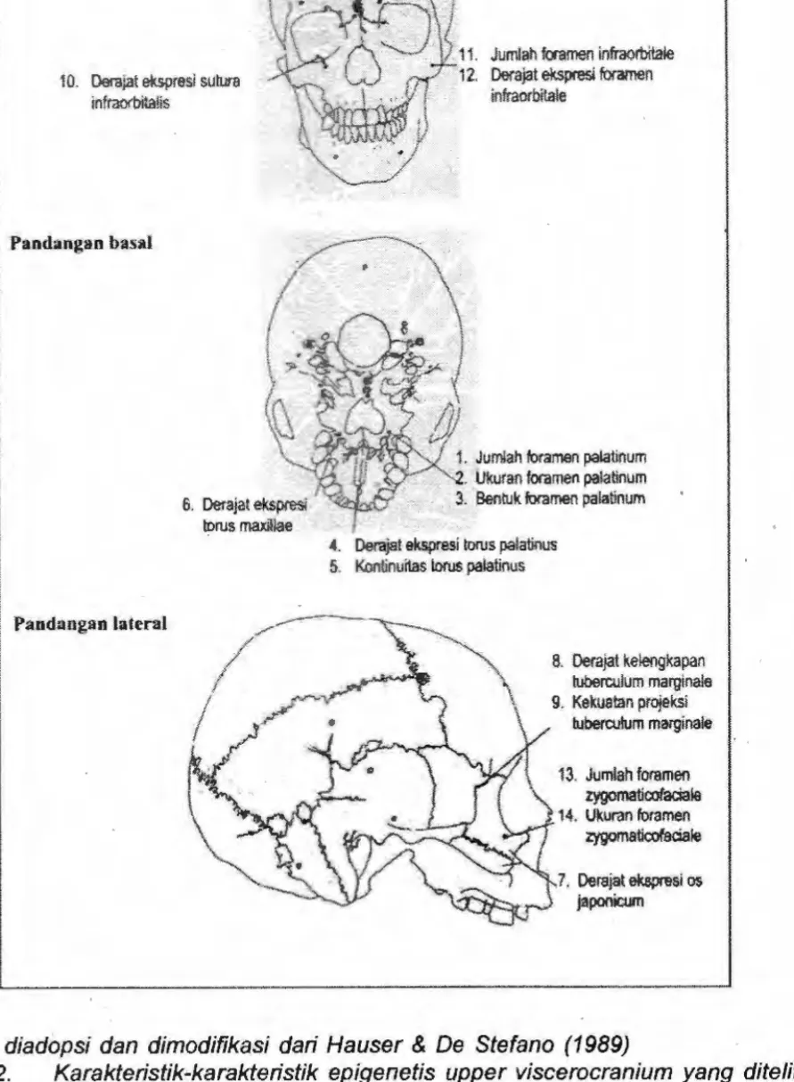 Gambar  2.  Karakteristik-karakteristik  epigenetis  upper  viscerocranium  yang  diteliti  dalam  pandangan  frontal,  basal  dan  lateral 