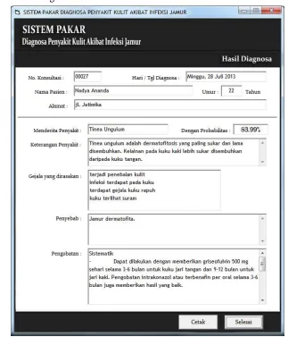 Gambar 5 Tampilan Form Hasil Diagnosa 