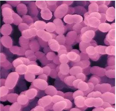 Gambar 2: Gambaran mikroskopis   Streptococcus      mutans   dengan   teknik    pewarnaan  