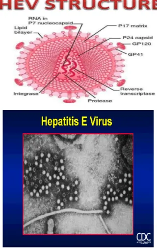 Gambar	6.	a,	b.	Hepatitis	E 	 	