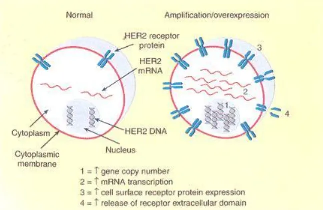 Gambar 2.4: Indikator status HER2: gen atau amplifikasi DNA dan mRNA atau overekspresi  protein