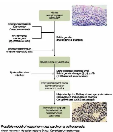 Gambar 3. Patogenesis karsinoma nasofaring (Dikutip dari: Tao Q, Anthony TC Chan. Nasopahryngeal Carcinoma: Molecular Pathogenesis and Therapeutic Developments in Expert 