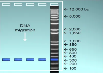 Gambar 2.12 Migrasi DNA Berdasarkan Molekul DNA