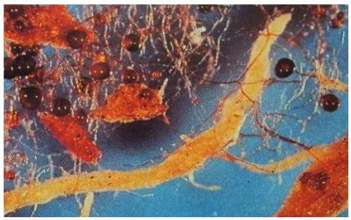 Gambar 5. Sebaran hifa dan spora Endomikorisa – Vesikular Arbuskular                   Mikoriza (VAM) (Sumber: Simanungkalit)