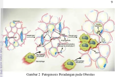 Gambar 2  Patogenesis Peradangan pada Obesitas  