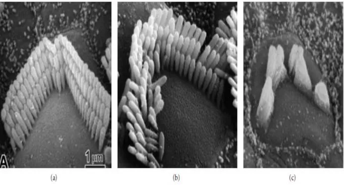 Gambar 2.6 Sel rambut luar normal (a) dan sel rambut luar setelah diberi paparan 
