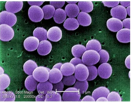Gambar 2.6. Bakteri Streptococcus mutans 