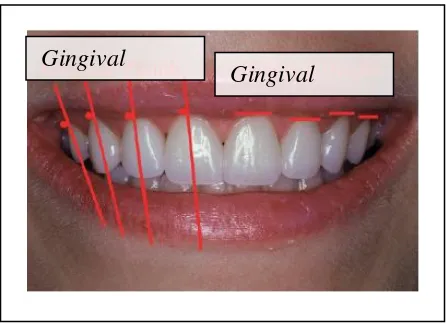 Gambar 3. Struktur gingiva1 