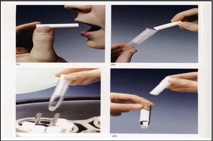 Gambar 3. Metode pengumpulan saliva dengan absorbent method19 