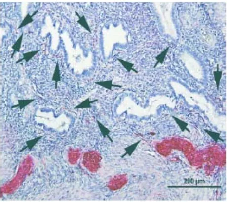 Gambar 7.   Serabut saraf pada lapisan Basal Endometrium dan perbatasan 