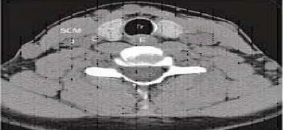 Gambar 1: Anatomi kelenjar Tiroid 9 