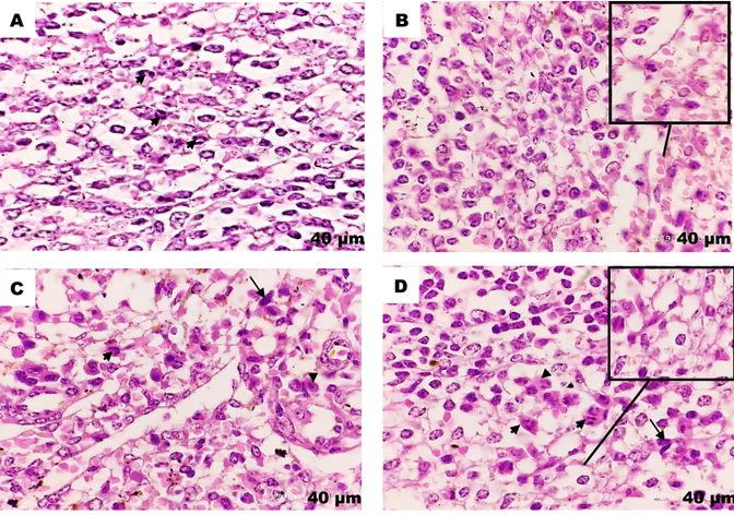Gambar 2. Hasil pewarnaan HE. (A) Organ limpa menunjukkan adanya sel neutrofil pada pulpa          merah (kepala panah); (B) Organ limpa menunjukkan adanya kongesti (gambar insert);  