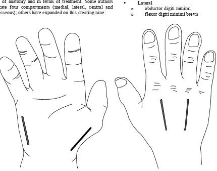 Fig. (7). The four incisions to decompress the hand. 