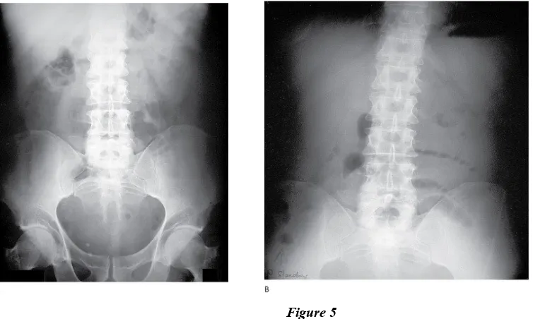 Figure 5The abdominal radiographs were interpreted as showing a “nonspecific bowel gas pattern.”