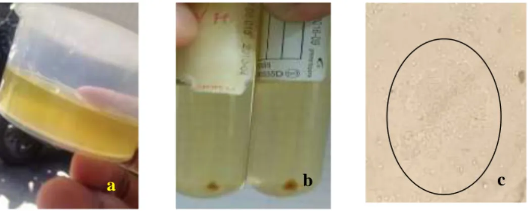 Gambar 1. (a) Secara fisik urin tampak normal; (b) uji sedimen urin tampak adanya  endapan; (c) teridentifikasi urolit urat 