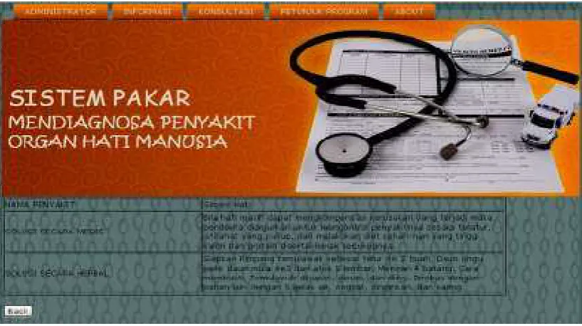 Gambar 16. Tampilan ���� Hasil Diagnosa 