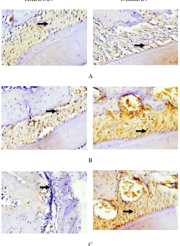 Gambar 3. Gambaran imunohistokimia ekspresi TGF -   pada sel fibroblas  jaringan ligamen periodontal Cavia cobaya