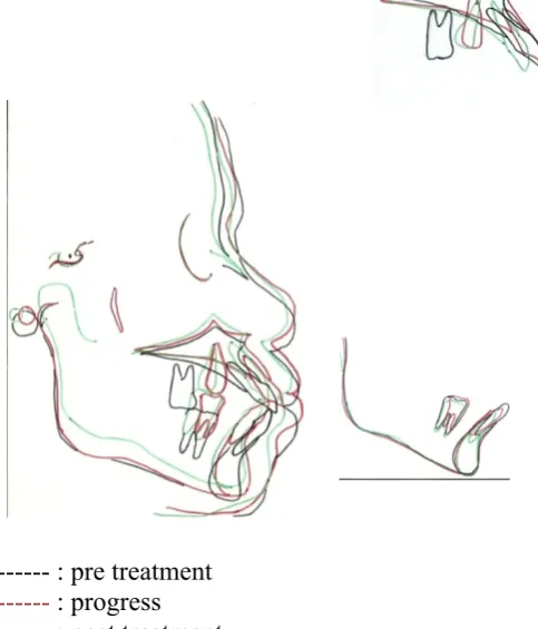 Figure 7. Retention phase (a) right side,(b) front side, (c) left side   