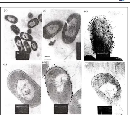 Gambar 2.10 Struktur sel bakteri E. Coli yang berinteraksi dengan  ion Ag+ : (a) Adanya electron-light region di tengah sel bakteri,  (b) condensed form dari DNA di tengah electron-light region, (c)  adanya jarak antara membrane sitoplasma dengan dinding s