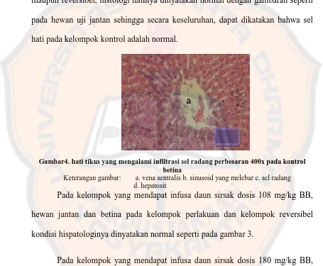 Gambar4. hati tikus yang mengalami infiltrasi sel radang perbesaran 400x pada kontrol betina 