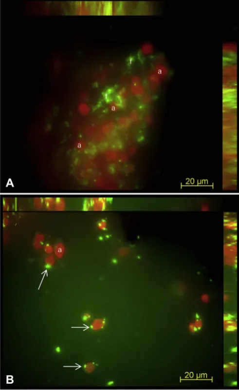 Fig. 6. Fluorescence microscopy 3D reconstruction MIP images of SYTOX Green stainedﬂdamaged membranes (arrows)