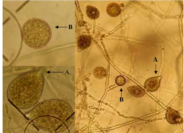 Gambar 3  P. palmivora : Sporangium (A) dan klamidospora (B) (Koleksi foto    pribadi)