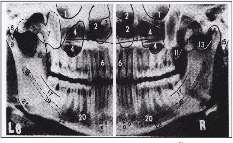 Gambar 1. Anatomi panoramik normal10 