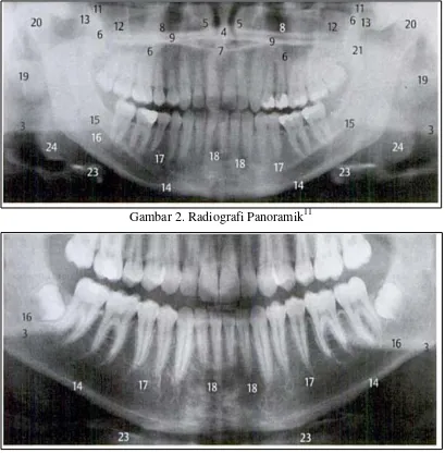 Gambar 2. Radiografi Panoramik11 
