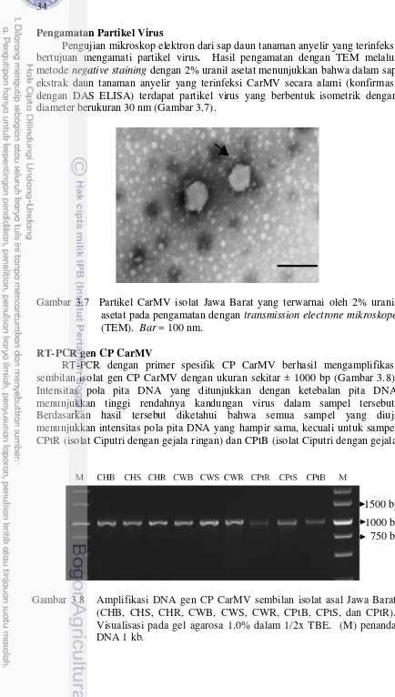Gambar 3.7  Partikel CarMV isolat Jawa Barat yang terwarnai oleh 2% uranil 