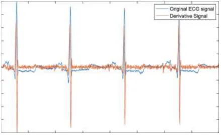 Gambar 2. 7 Derivative Signal ECG [17] 