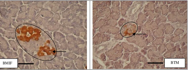 Gambar 4. Foto mikrograf sel-β (          )  pada jaringan pankreas tikus,berperan menghasilkan dan mensekresikan insulin