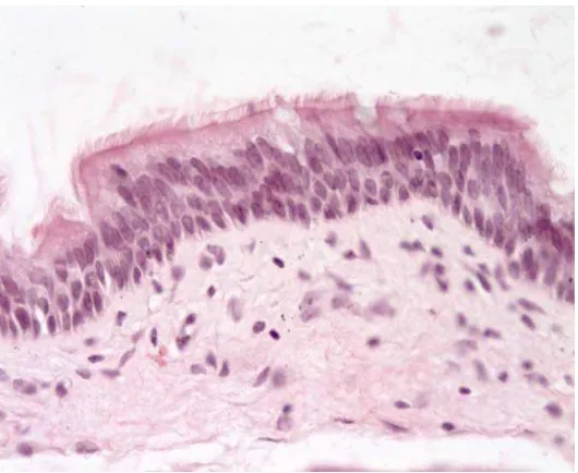 Gambar 2.2 Sel epitel transisional, pelapis nasofaring (Dikutip dari : Respiratory system pre lab [cited 2010 Jan 5]