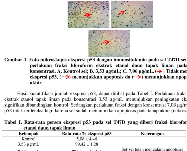 Gambar 1. Foto mikroskopis ekspresi p53 dengan imunositokimia pada sel T47D setelah diberi  perlakuan  fraksi  kloroform  ekstrak  etanol  daun  tapak  liman  pada  berbagai  konsentrasi