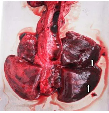 Gambar 4. Fibrosis (HE, 400x) 