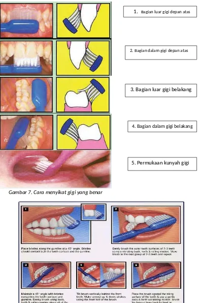 Gambar 8. Cara menyikat gigi yang benar