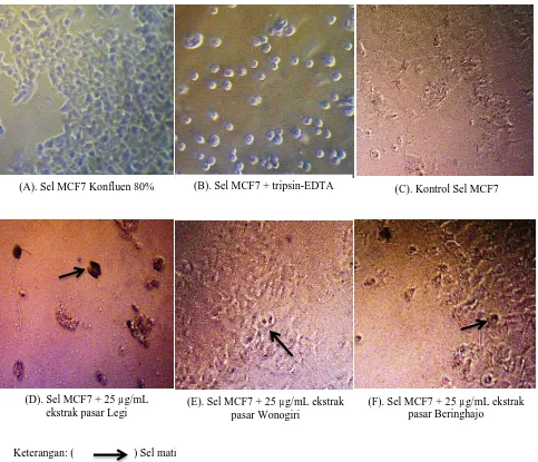 Gambar 2. Morfologi sel MCF7 menggunakan mikroskop sitotoksik) 