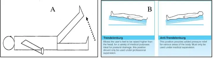 Gambar 4. A. Posisi syok ( shock position) dan B. Posisi Trendelenburg 