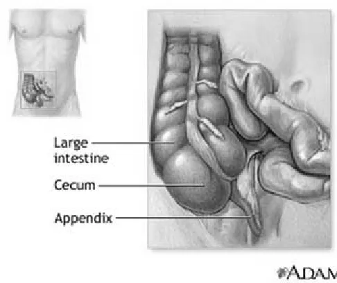 Gambar 2. Anatomi Appendiks