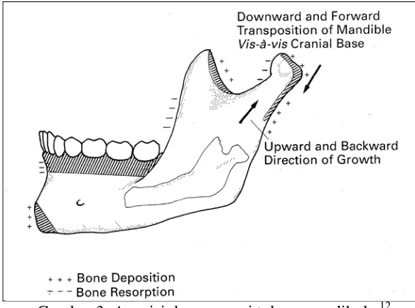 Gambar 3. Aposisi dan resorpsi tulang mandibula.12