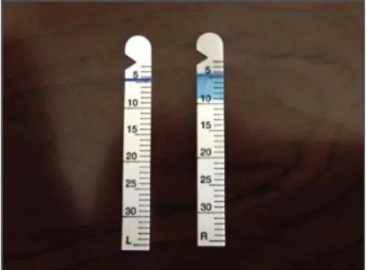 Gambar  3.7  Schirmer’s  strip  dengan  penanda  millimeter.  Pewarnaan  biru  memfasilitasi hasil pengukuran volume air mata