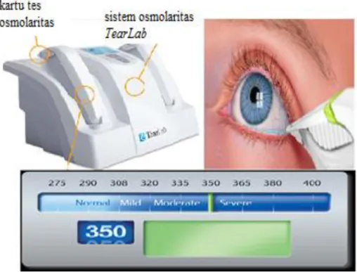 Gambar 3.8 Alat, cara penggunaan dan interpretasi hasil  osmometer  Dikutip dari: Tomlinson dkk 14 