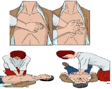 Gambar 2.6: Posisi Penolong Pijat Jantung (sumber: Resuscitation  European Resuscitation Council Guidelines for  2010)
