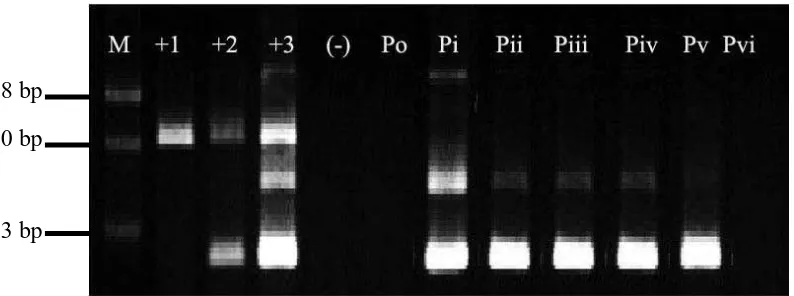 Gambar 4.6 Hasil Diagnosis RT-PCR 