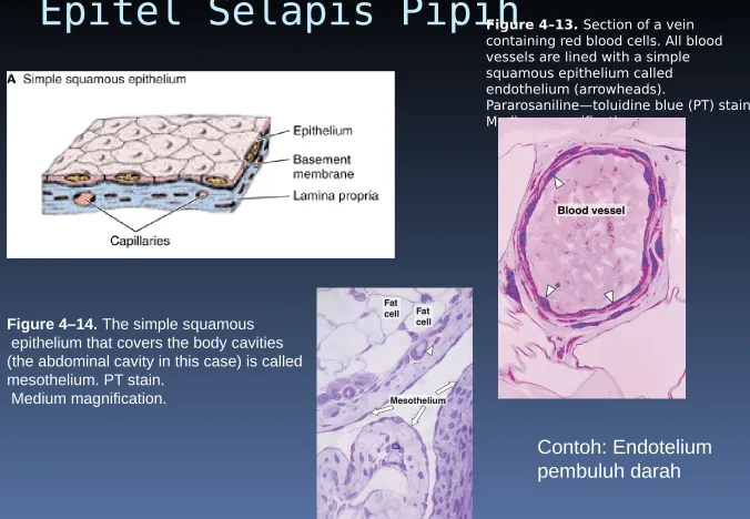 Figure 4–14. The simple squamous