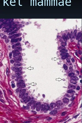 Figure 4–23. Section of the secreting portion of a mammary gland; apocrine secretion is characterized by the discharge of the secretion product with part of the cytoplasm (arrows)