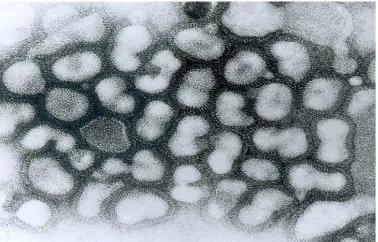 Gambar SEM Virus Avian Influensa
