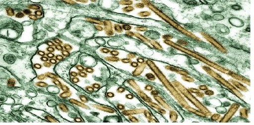 Gambar TEM Virus H5N1 pada Paru-paru